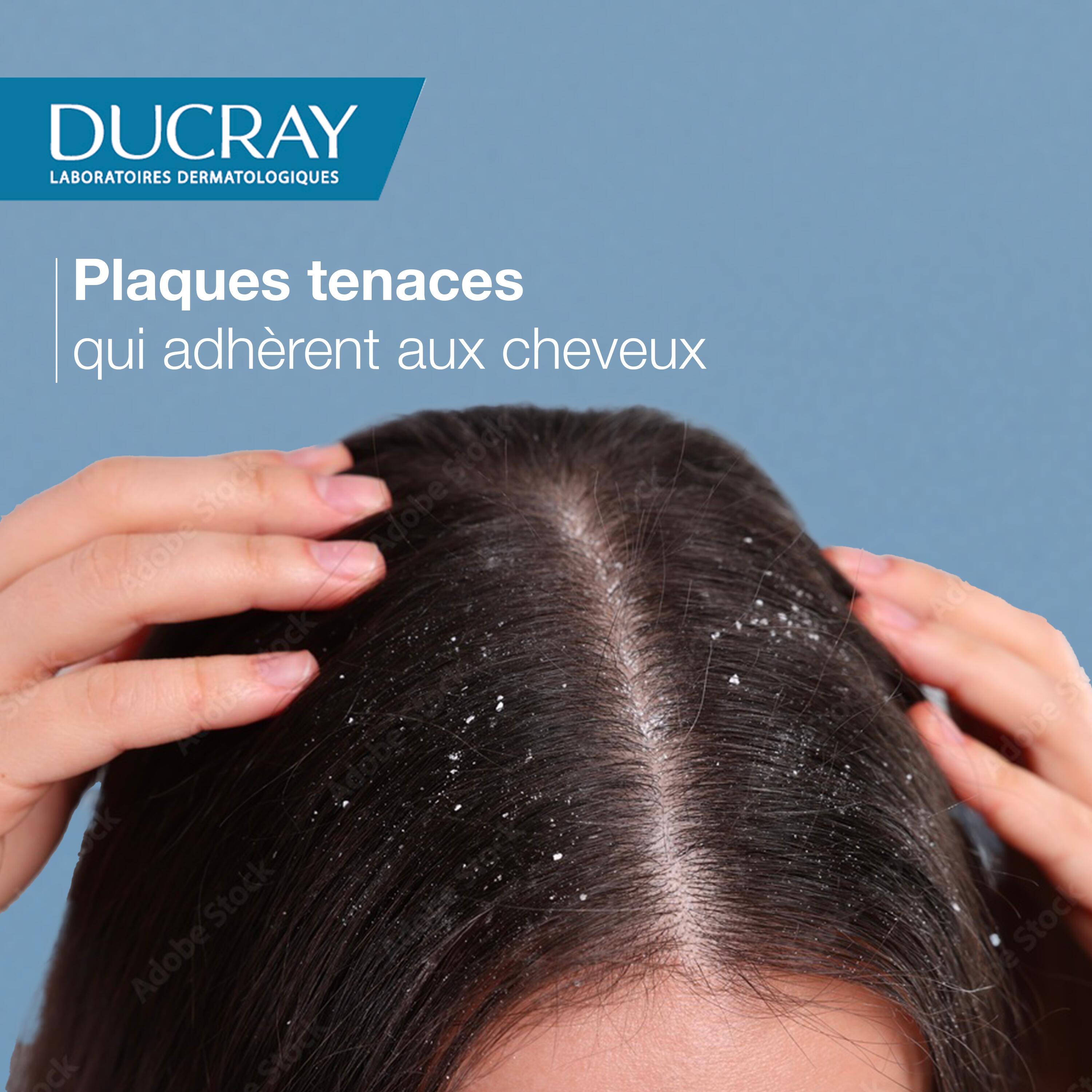 Ducray Shampooing traitant régulateur - Pellicules grasses KELUAL SQUANORM 200 ml