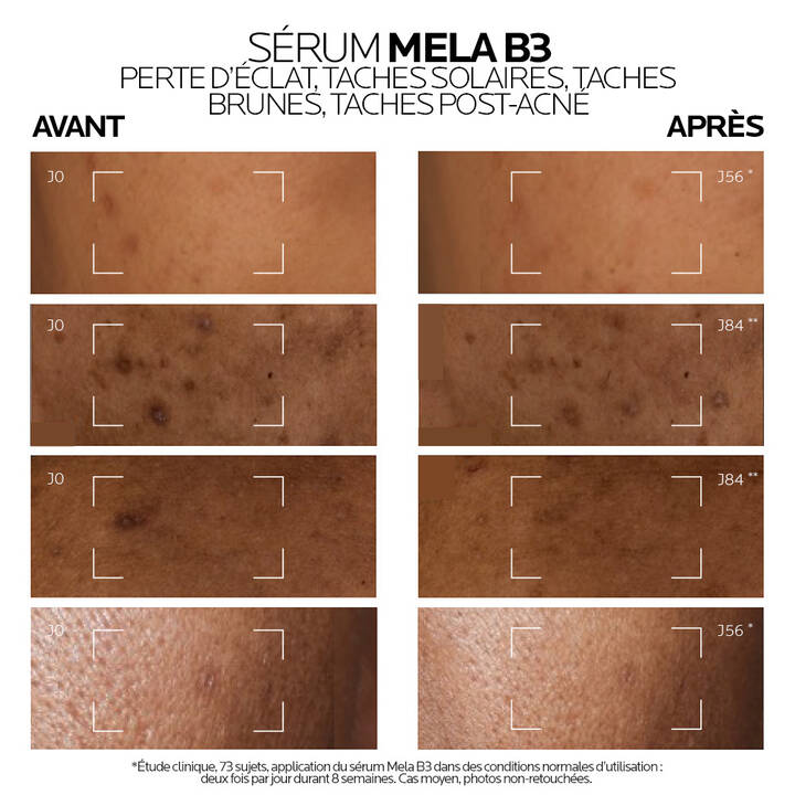 FESTIVAL LA ROCHE POSAY MELA B3 SÉRUM CONCENTRÉ INTENSIF ANTI-TACHES ANTI-RÉCIDIVE + 10 ml offerte