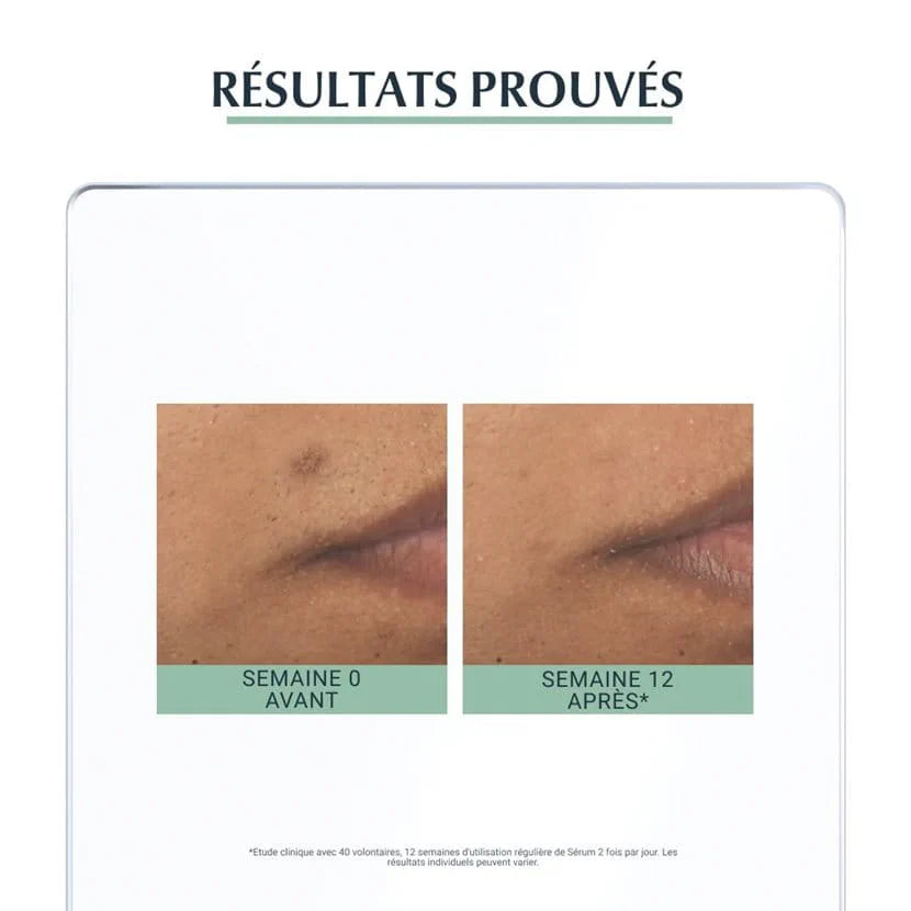 Eucerin DERMOPURE TRIPLE ACTION SÉRUM