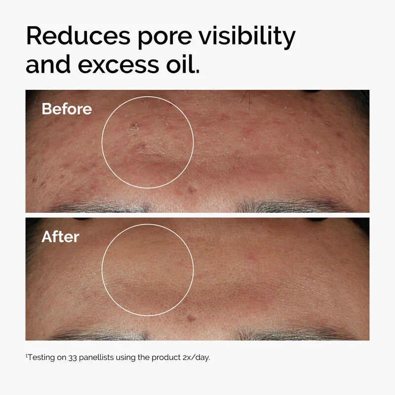 THE ORDINARY NIACINAMIDE 10%+ZINC1% 30ML